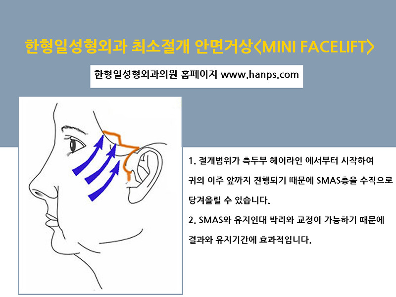 안면거상잘하는병원, 무엇을 기준으로 선택해야 할까?