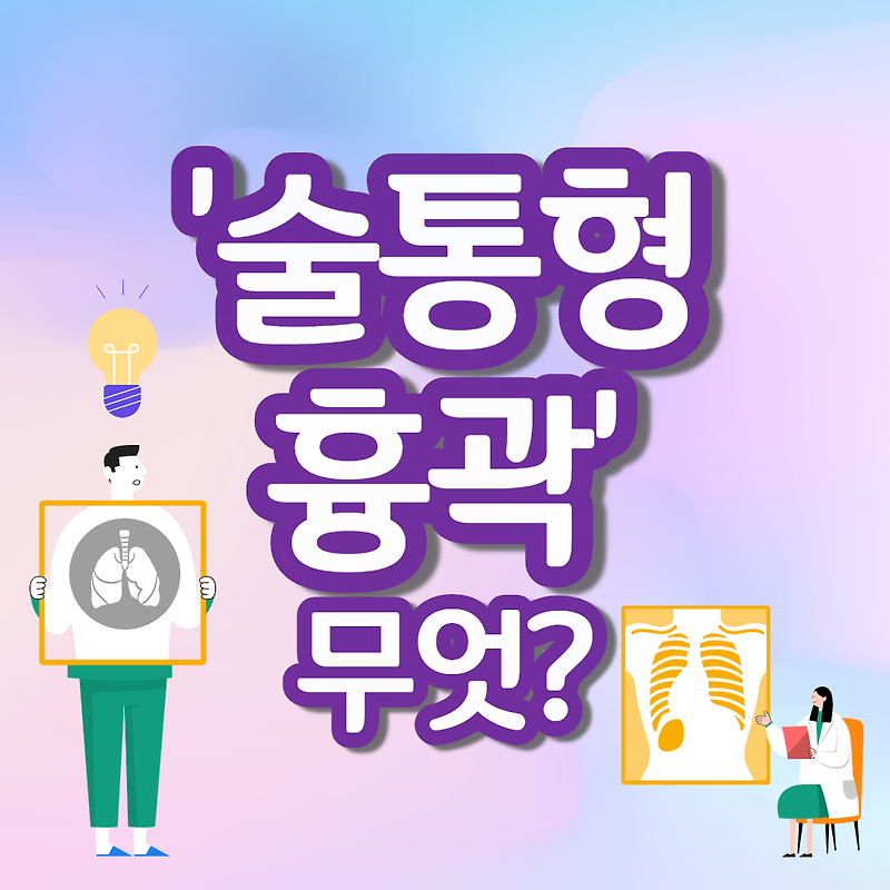 술통형흉곽 뜻