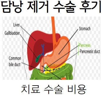 인천인하대학교병원 담석증 담낭제거 로봇수술후기 (슬기로운 입원생활/복강경수술비용) 3