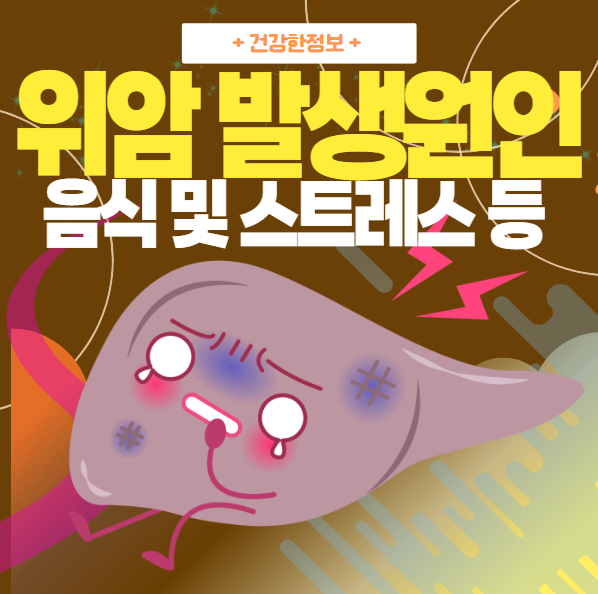 위암 발생(재발) 원인, 음식 및 스트레스