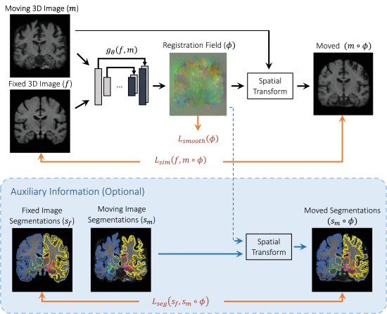 [논문 리뷰] VoxelMorph: A Learning Framework for Deformable Medical Image Registration