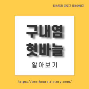 구내염과 혓바늘 가이드!! 입안의 불청객들!!