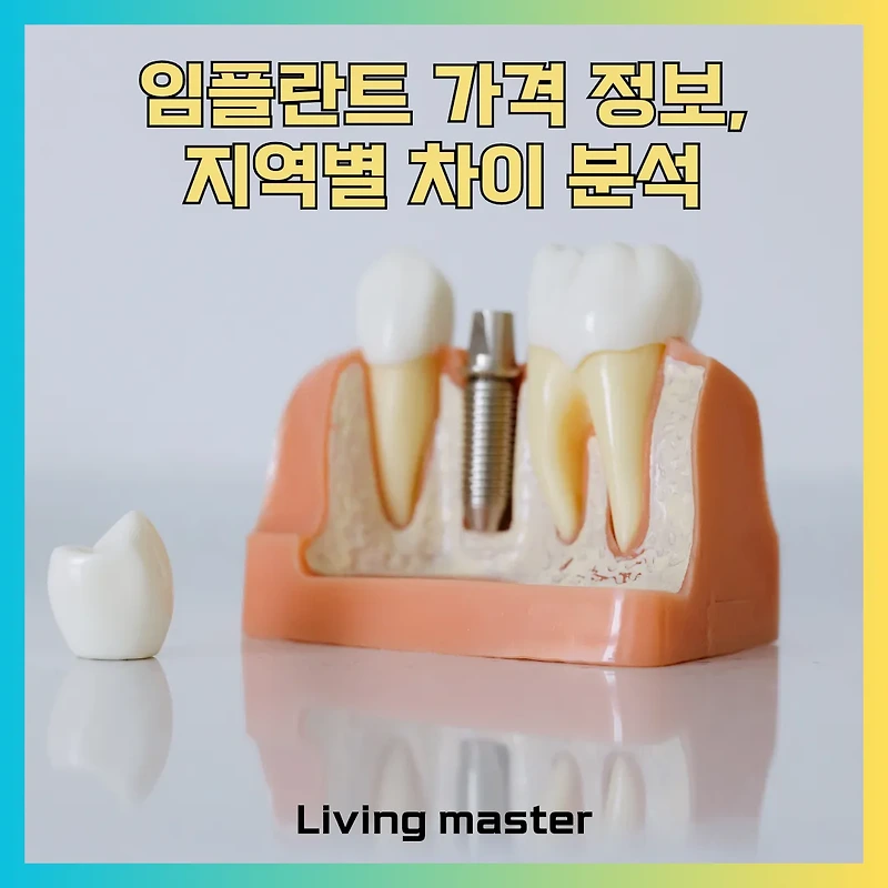 임플란트 지역별 가격 차이 총정리, 서울, 지방 주요 도시 일반적인 가격대와 확인 시 주의점