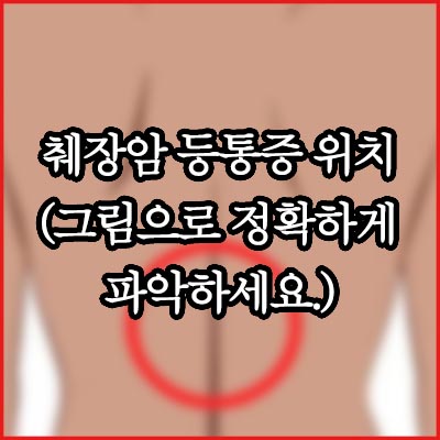 췌장암 허리 통증 위치 (그림으로 정확하게 파악하세요.)