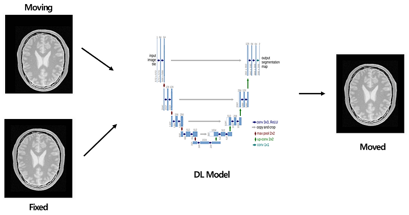 Medical Image Registration