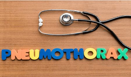 기흉(Pneumothorax) : 정의, 원인, 증상, 진단방법, 치료방법