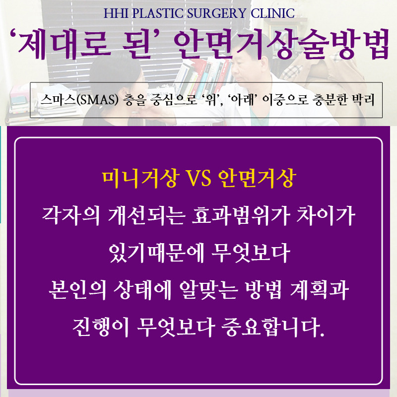 미니거상 할까? 안면거상 할까?