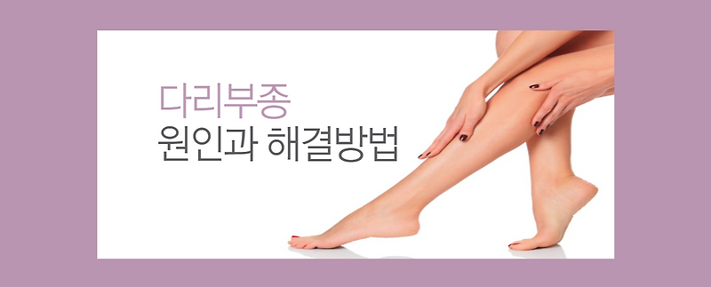 다리부종(다리부종) 통증의 원인분석, 셀프마사지 치료방법(다리부종제거, 혈액순환)