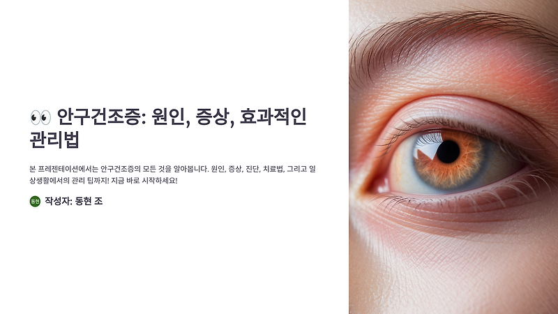 🛑 눈이 타들어간다면? 안구건조증 지금 당장 해결하자!