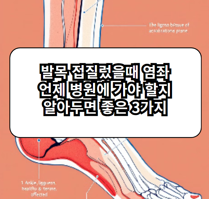 발목 접질렀을때 염좌 언제 병원에 가야 할지 알아두면 좋은 3가지