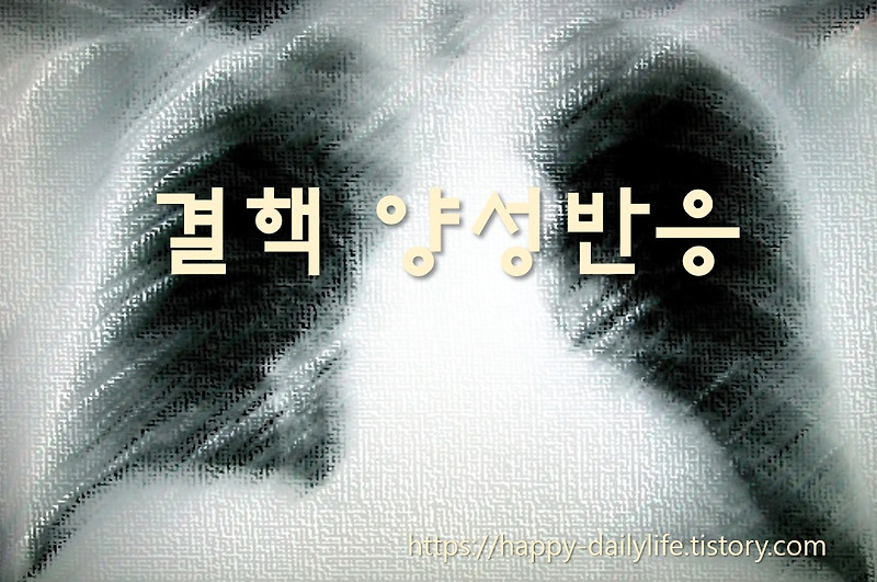 가래 빼는 법과 삭히는 법