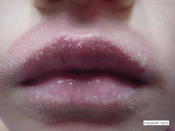 Licking Of Lip