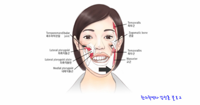 가성안면비대칭과 진성안면비대칭