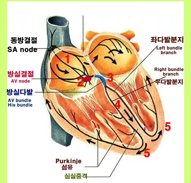 심장의 생리 - 심장전도계 Conduction system ( 부정맥 Arrhythmia ② )
