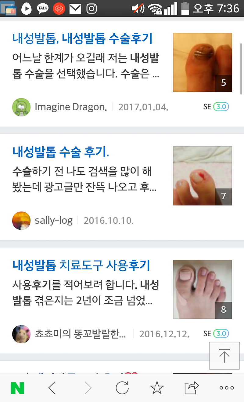 내성발톱 수술후기 남겨봅니다.. :: PhotoC의 생각일기