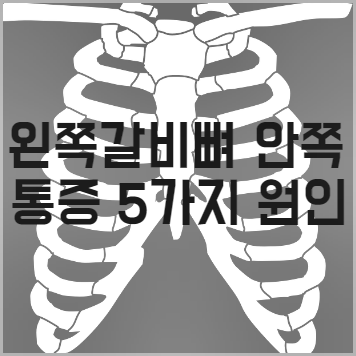 왼쪽 갈비뼈 안쪽 통증 5가지 원인