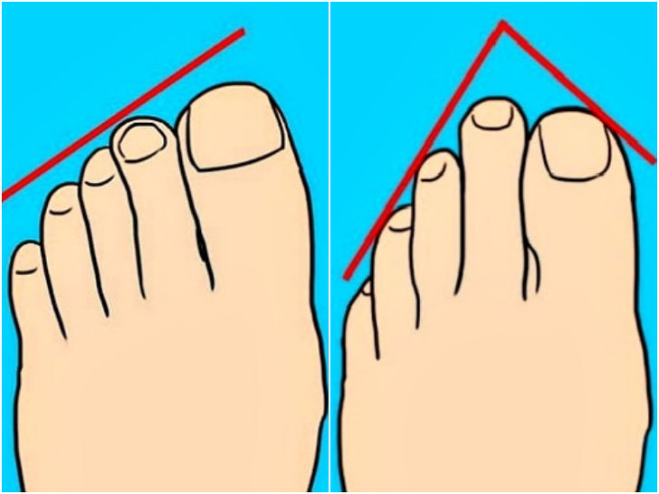 8가지 유형의 '발가락 모양'으로 알아보는 성격 테스트