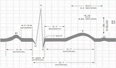 심전도 판독법 EKG 판독 도우미 :: 곰팅이