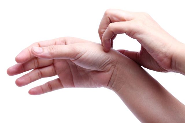 손등 두드러기 - 소양증 원인, 습진 치료방법 5가지
