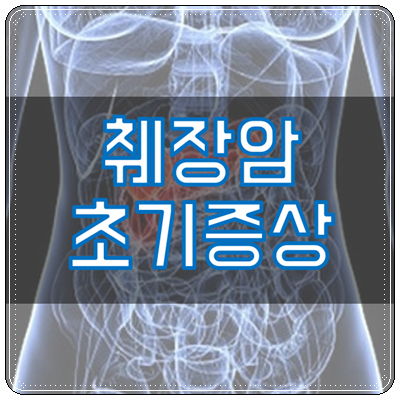 췌장암 초기증상 원인 예방 - shbloginfo