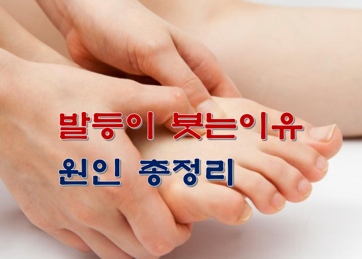 Top 13 발등 이 붓는 이유 All Answers