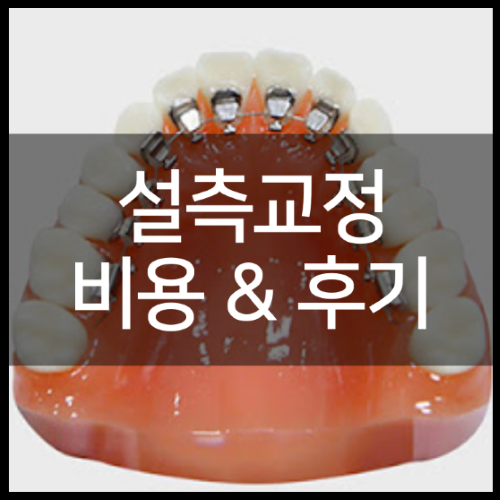 언어 치료의 단점, 기간 및 비용 요약