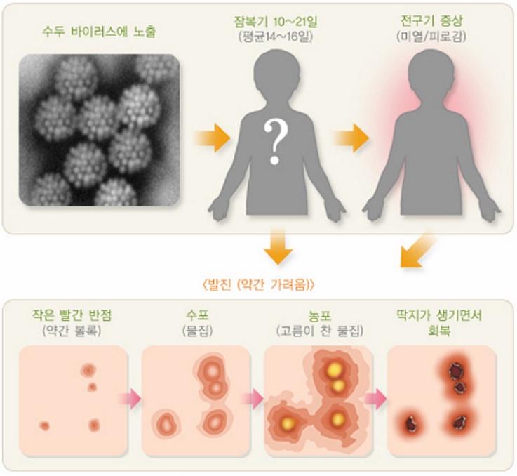 아이에게 붉은 반점이 생겼다면? 원인은 이것! - LIFE STYLE :-)