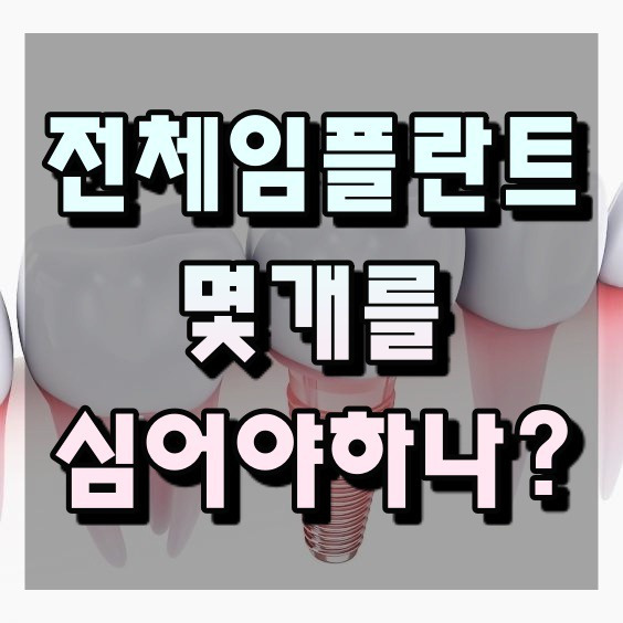 전체임플란트 가격 비용 몇개심어야하나