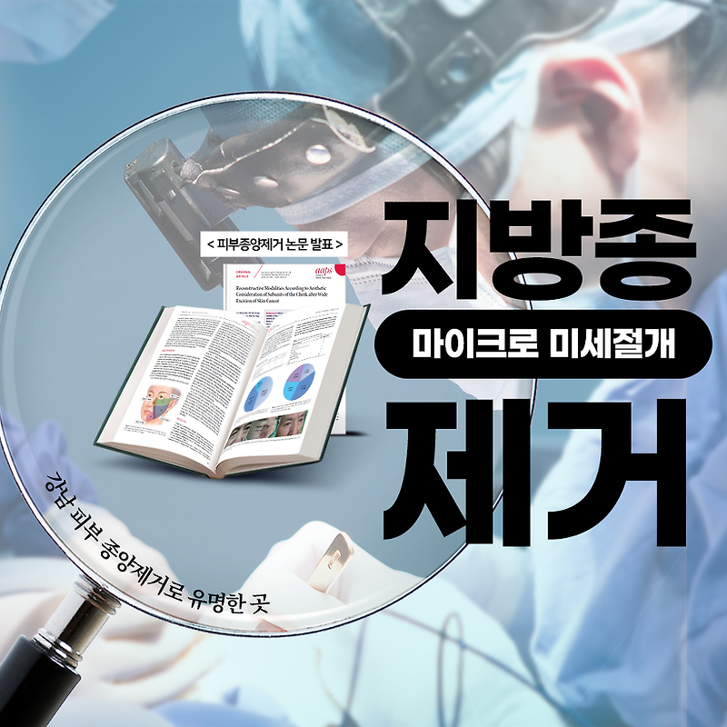 얼굴 지방종 제거수술 비용과 17년 경력 병원 (강남-서초)