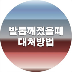 발톱깨졌을때 처치방법