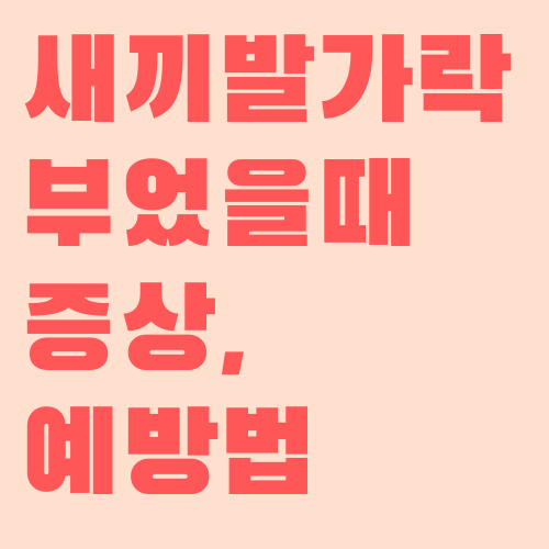 새끼발가락 부었을 때 증상, 예방법 :: 양슬의 웰빙 라이프
