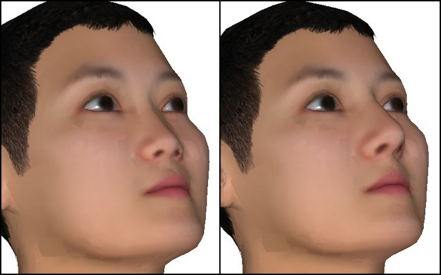 코 낮은 사람은 어떤 안경을 선택하는 게 좋을까?