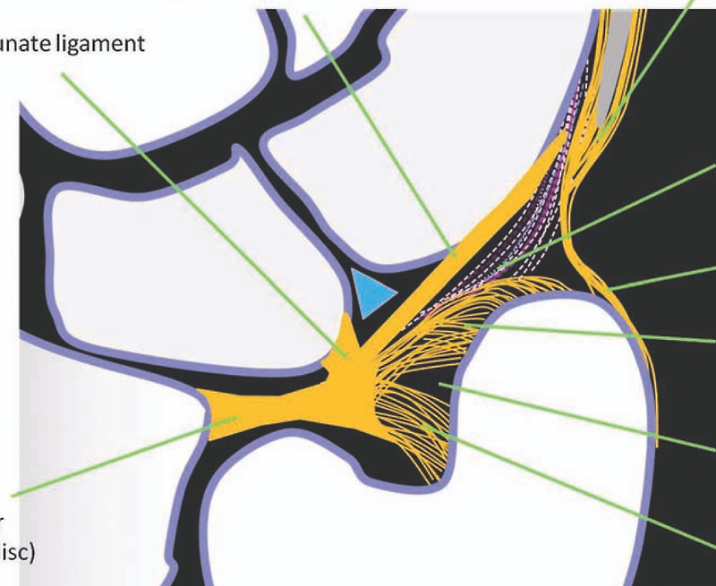 Triangular fibrocartilage complex (TFCC) - 1 (Triangular ...