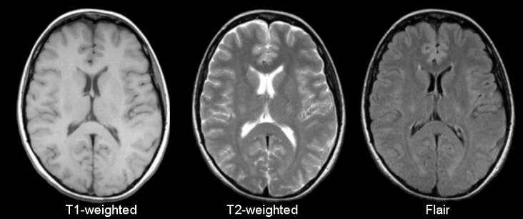 Mri Weighting T1 Vs T2 비교