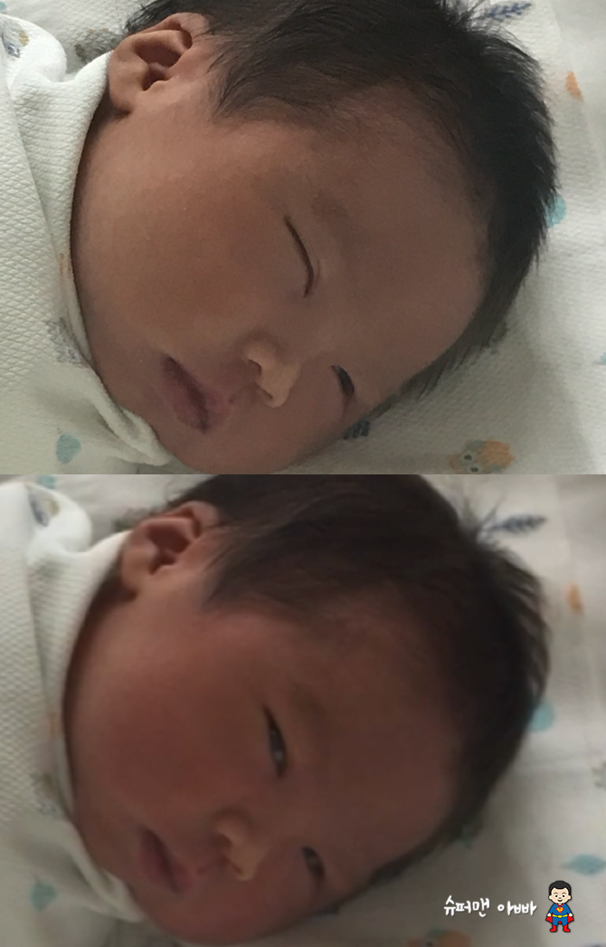 [D+3~4] 제왕절개 후 첫 식사, 신생아 눈 뜨는 시기, 모유 유축 및 수유