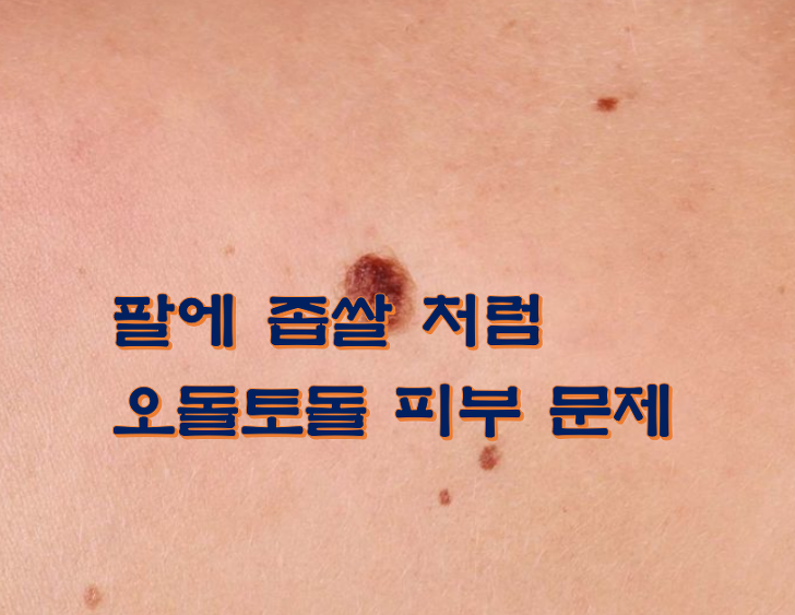 팔에 좁쌀 처럼 하얀색 알갱이 원인