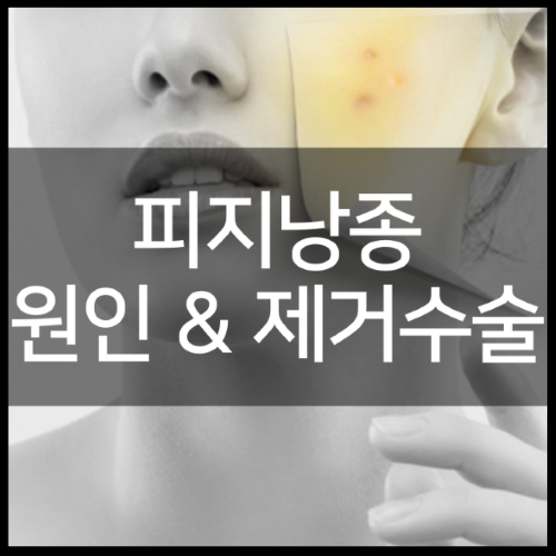 피지낭종 제거수술 및 원인부터 수술병원 가격 정리