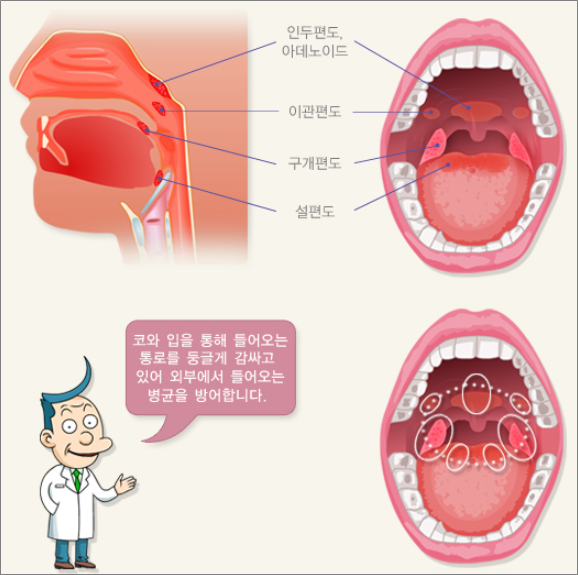 편도제거수술 전.후 주의사항 및 팁