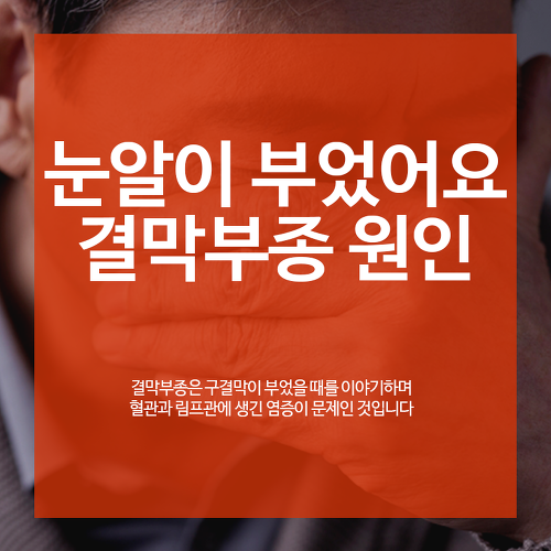 아이시티안과 공식블로그 :: 눈알이 부었어요, 결막부종 원인은 무엇일까?