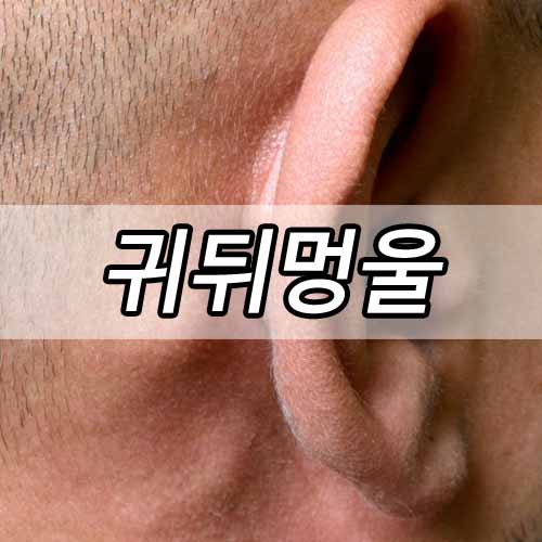 귀뒤멍울 생기는 이유 4가지와 자연 치유하는 방법