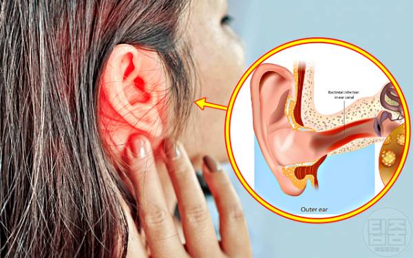 귀에서 삐소리 이명 증상 원인 6가지 고혈압 외이도염 턱관절
