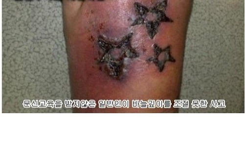 천안 타투 문신 시술 실패