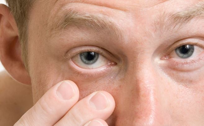 안대 착용법 과 눈 다래끼 안대 하는 이유