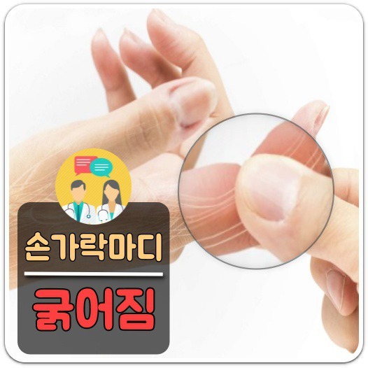 손가락 마디 굵어짐 원인/치료방법, 의학정보 톡톡!!