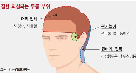 두통이 심할 때 도움되는 응급처치 방법 - 머리가 깨질듯이 아플 때