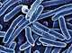 출처: Euronews. E.coli outbreak widens to 15 states, CDC says
