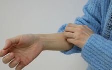 손발이 땀에 젖거나 상처 생기면… HPV 감염돼 '사마귀' 위험
