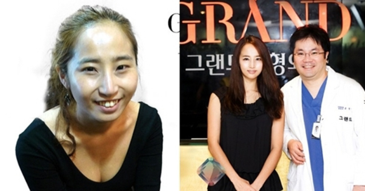 슈스케 에로배우 최은 양악수술, 신이 신은경 이어 '페이스오프'