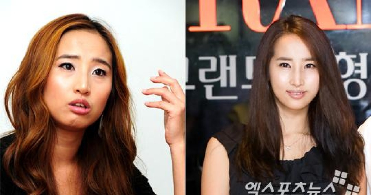 최은, 양악수술 사진 공개, 네티즌 