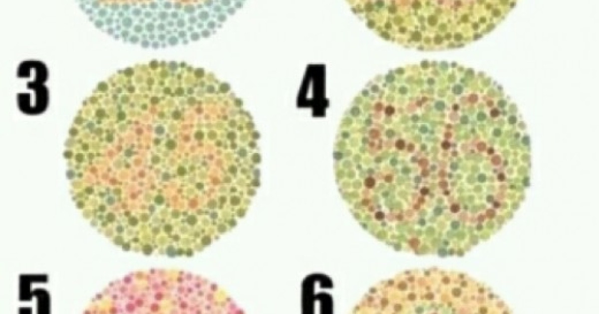 색맹테스트 5번 안 보이면 동성애자? 보이는 사람이 이상